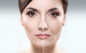 /faxingzaoxing/886.html