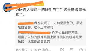 女人睫毛变白要警惕_或营养健康问题，需关注！