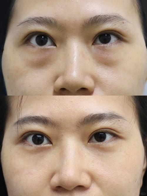 为什么女生化妆眼袋那么明显_选对遮瑕，巧用技巧显年轻