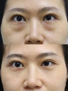 为什么女生化妆眼袋那么明显_选对遮瑕，巧用技巧显年轻