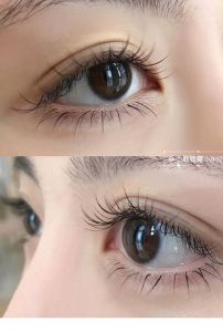 下睫毛正常图片_睫毛少或掉多？注意清洁和健康！