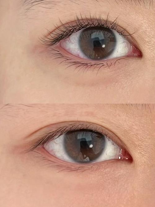 下睫毛正常图片_睫毛少或掉多?注意清洁和健康! 下睫毛正常图片_睫毛少或掉多?注意清洁和健康!