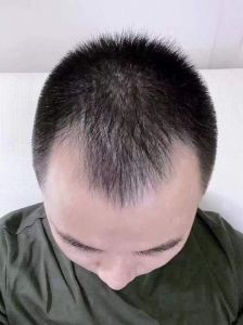 m头秃顶最适合的发型_锡纸烫露额括号寸头光头