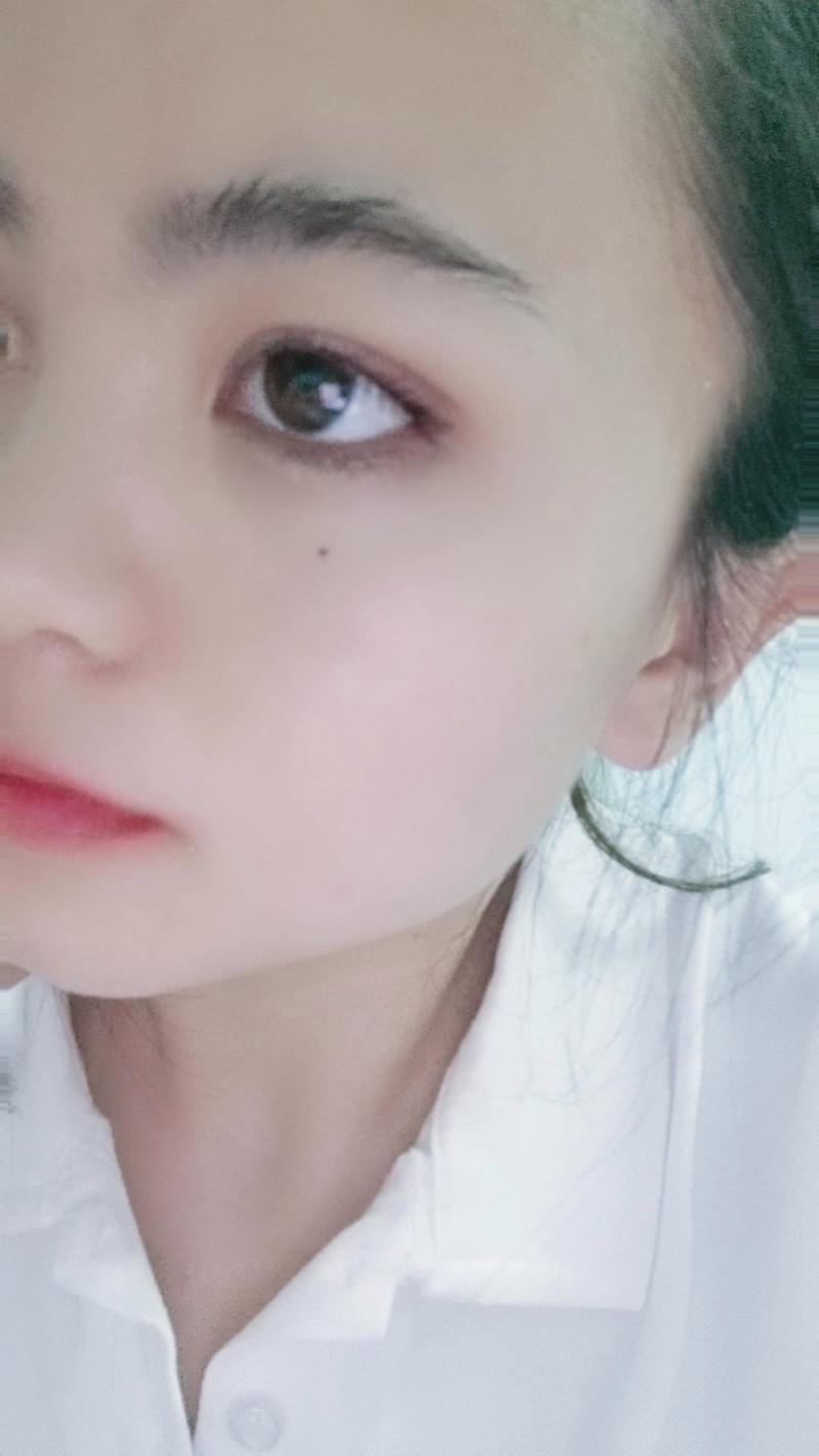 女人右眼下睫毛中间处长痣_注意变化，或属良性，日常防晒护理